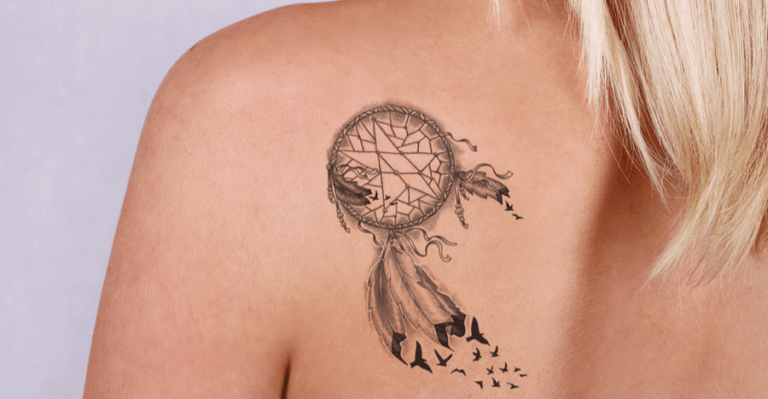 Laser Tattoo Removal