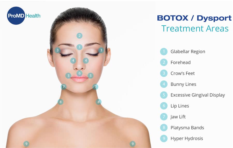Botoxtxareas
