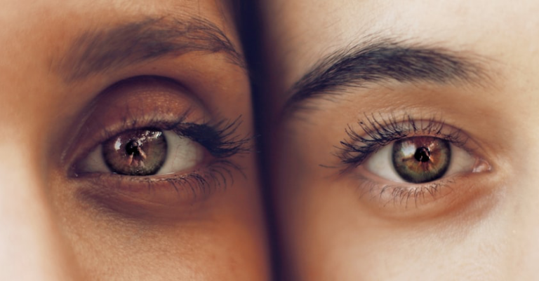 eyes