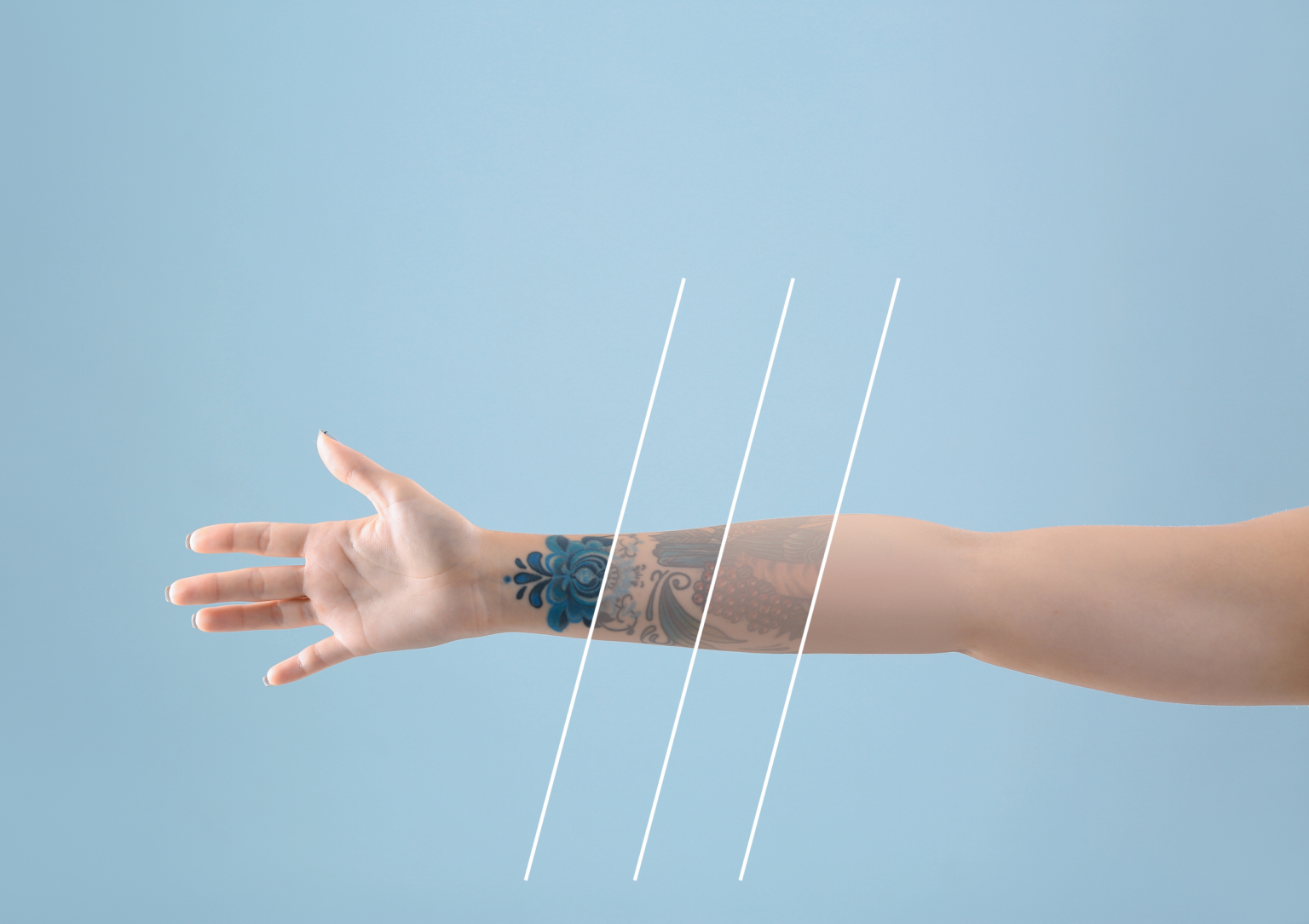 Tattoo Removal at ProMD Health Desktop