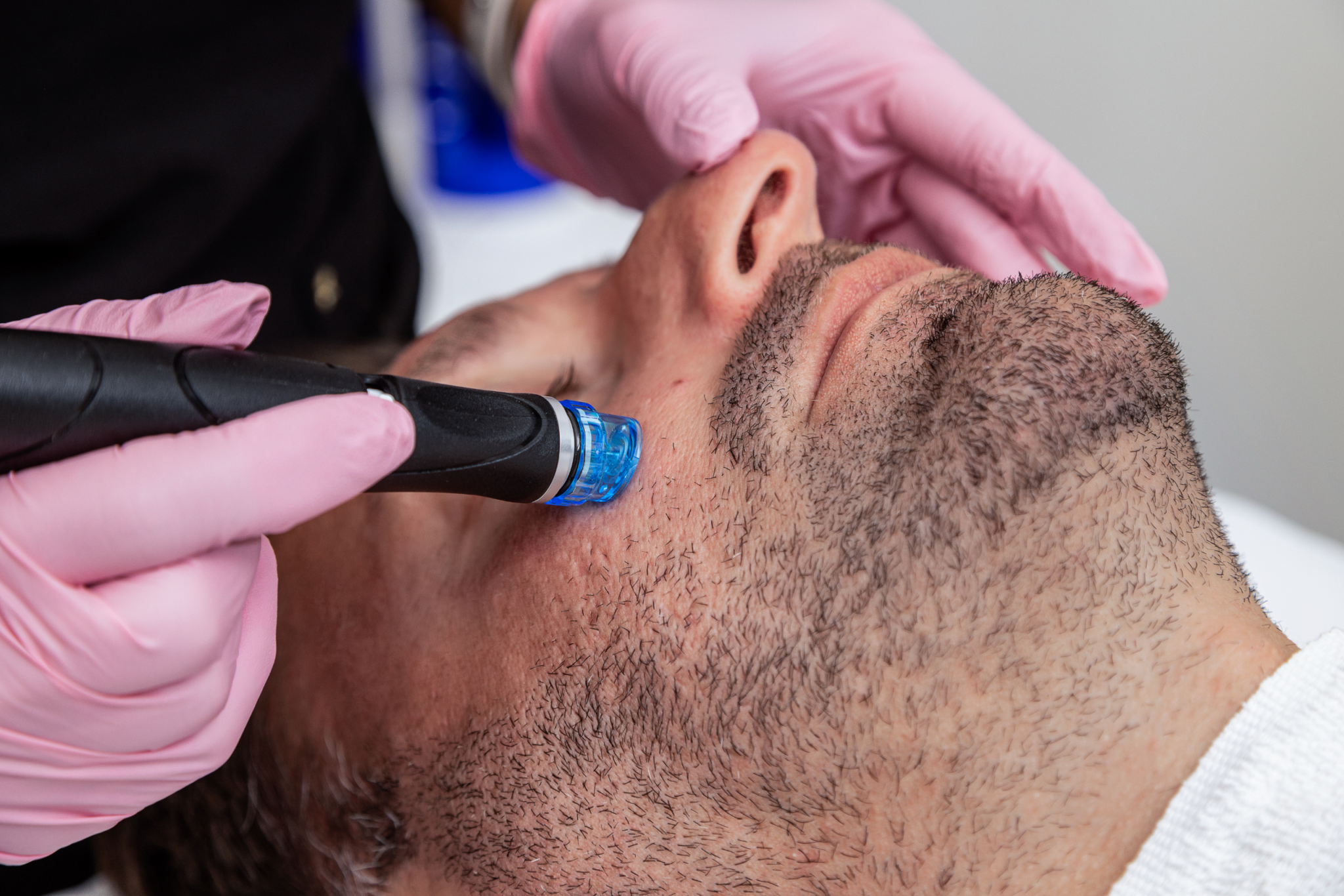 Hydrafacial