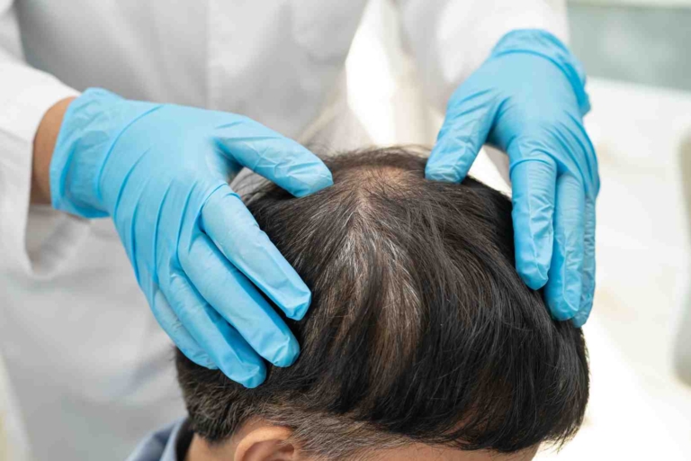 best hair treatment for thinning hair