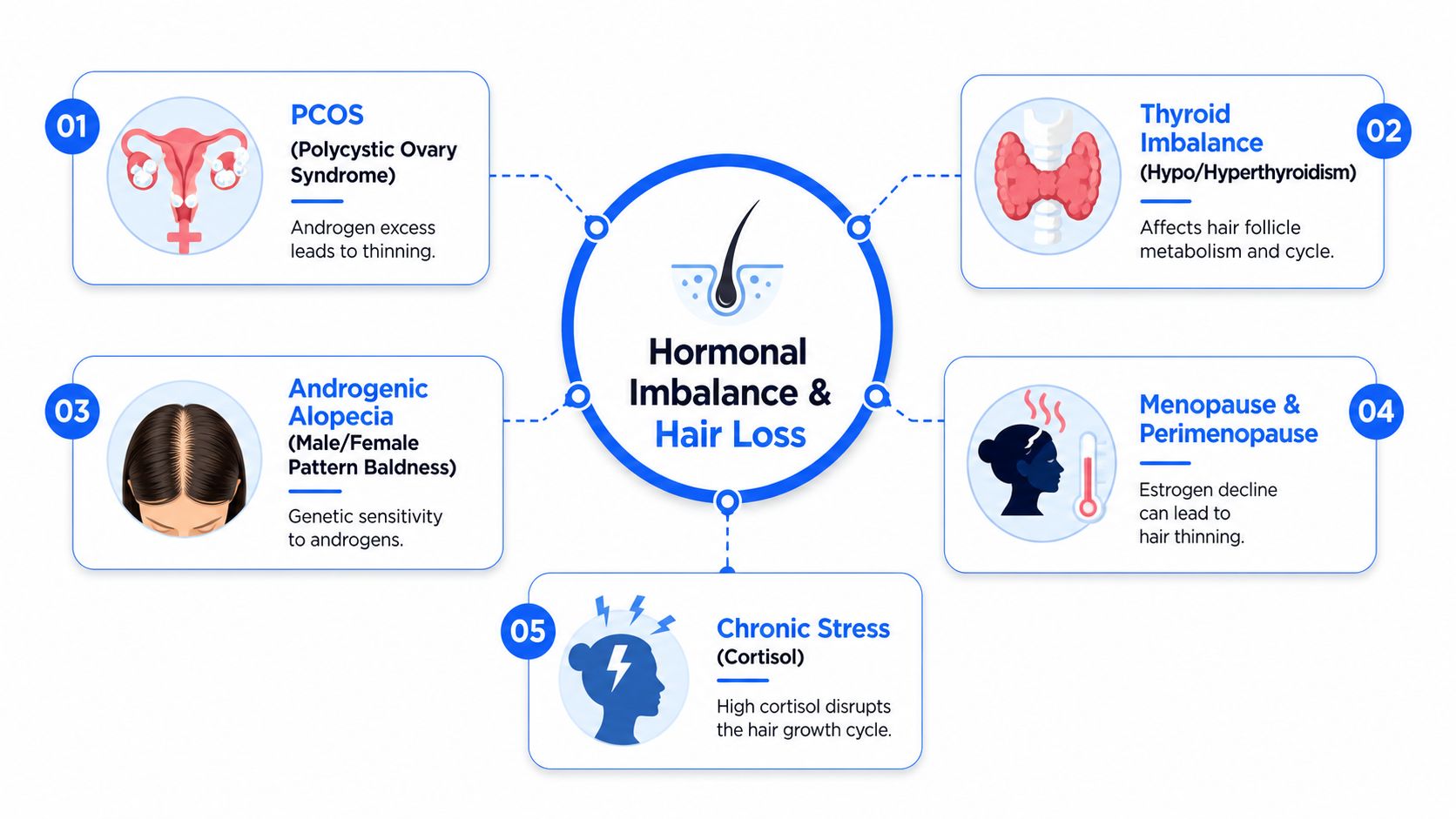 A diagram illustrating five major causes of hormonal imbalance and hair loss including stress and thyroid issues.