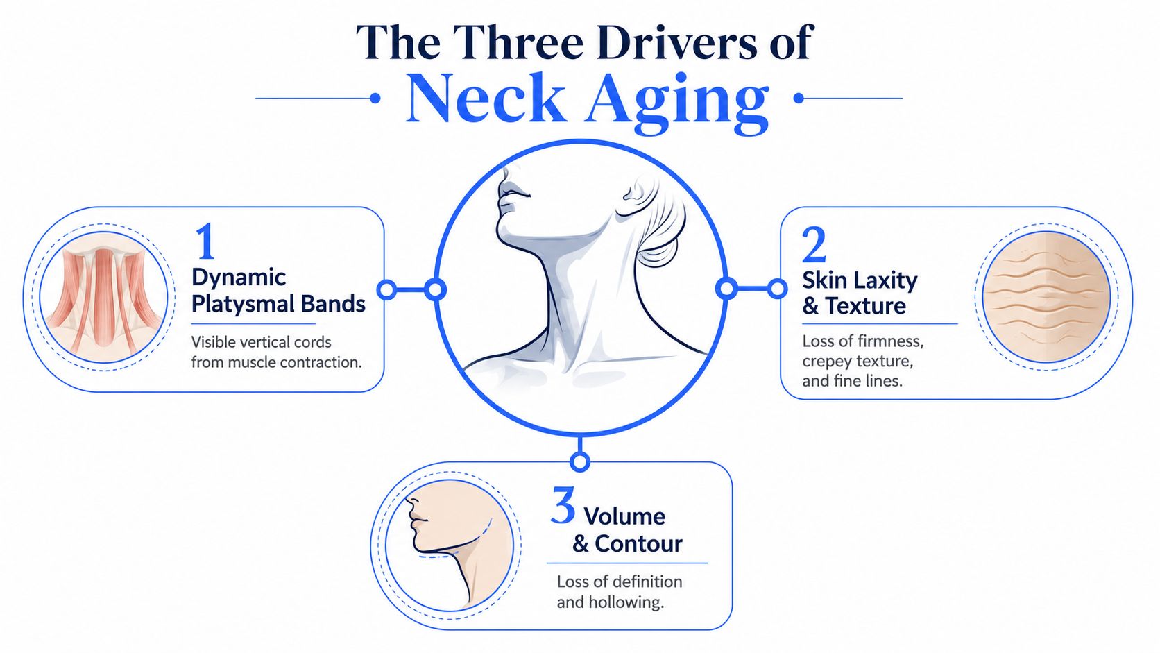 An infographic illustrating the three main biological drivers of neck aging: platysmal bands, skin texture, and loss of volume.