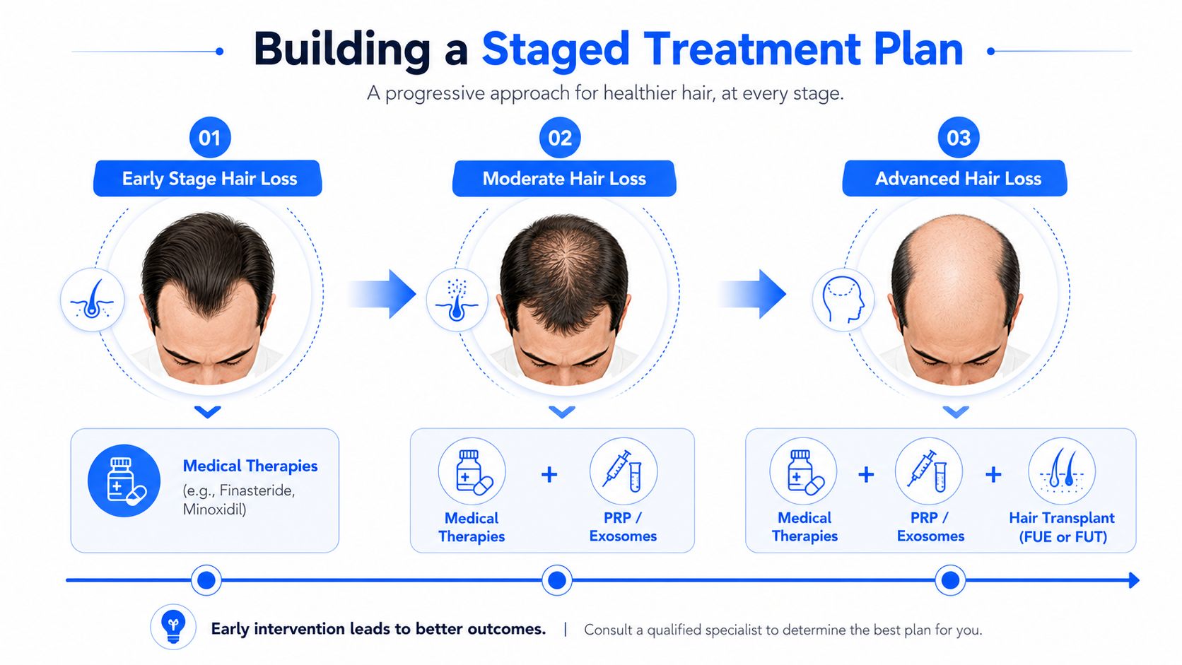 A diagram illustrating a staged treatment plan for male hair loss from early to advanced stages.