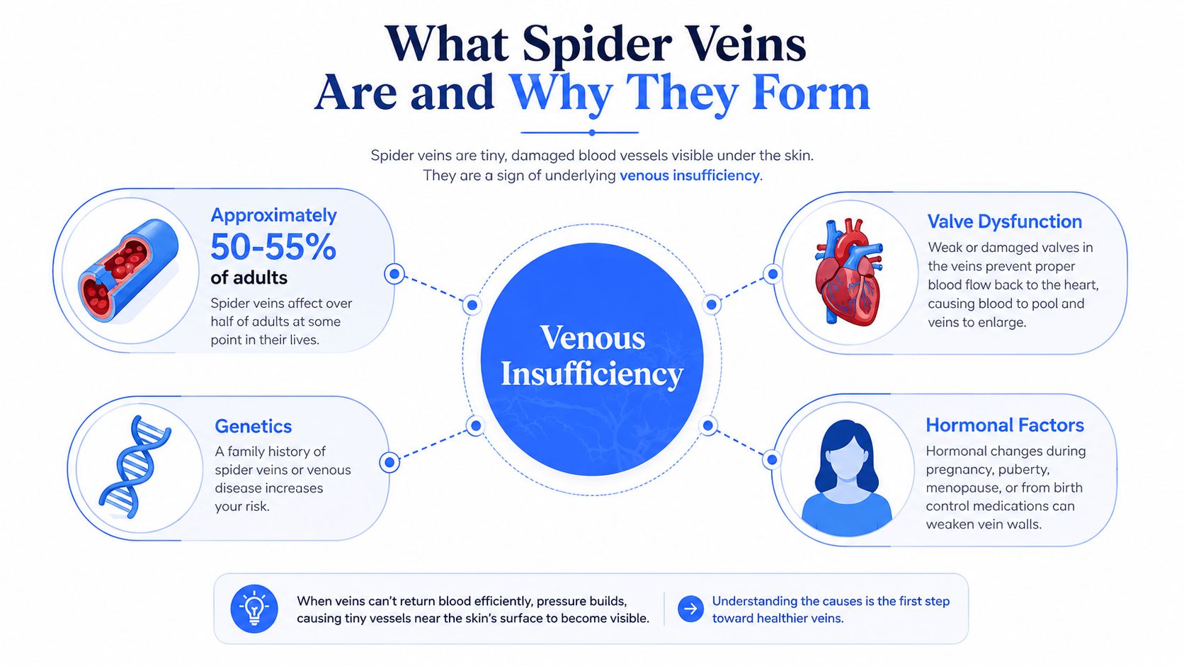 An infographic explaining how venous insufficiency causes spider veins, featuring statistics, genetic factors, and hormonal influences.