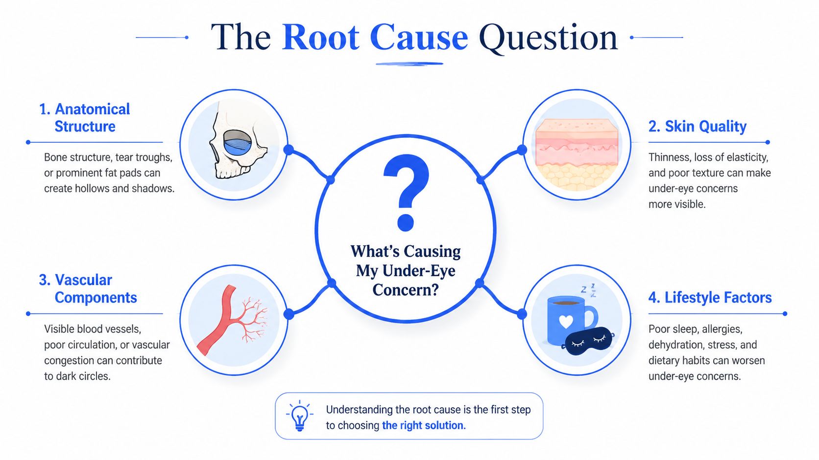 An infographic titled The Root Cause Question explaining four factors that contribute to under-eye concerns.