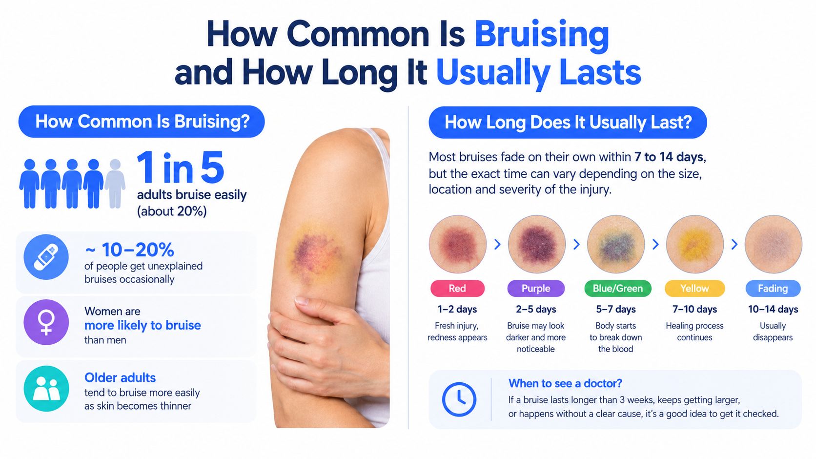 An infographic detailing the prevalence of bruising in adults and the typical timeline of color changes during the healing process.