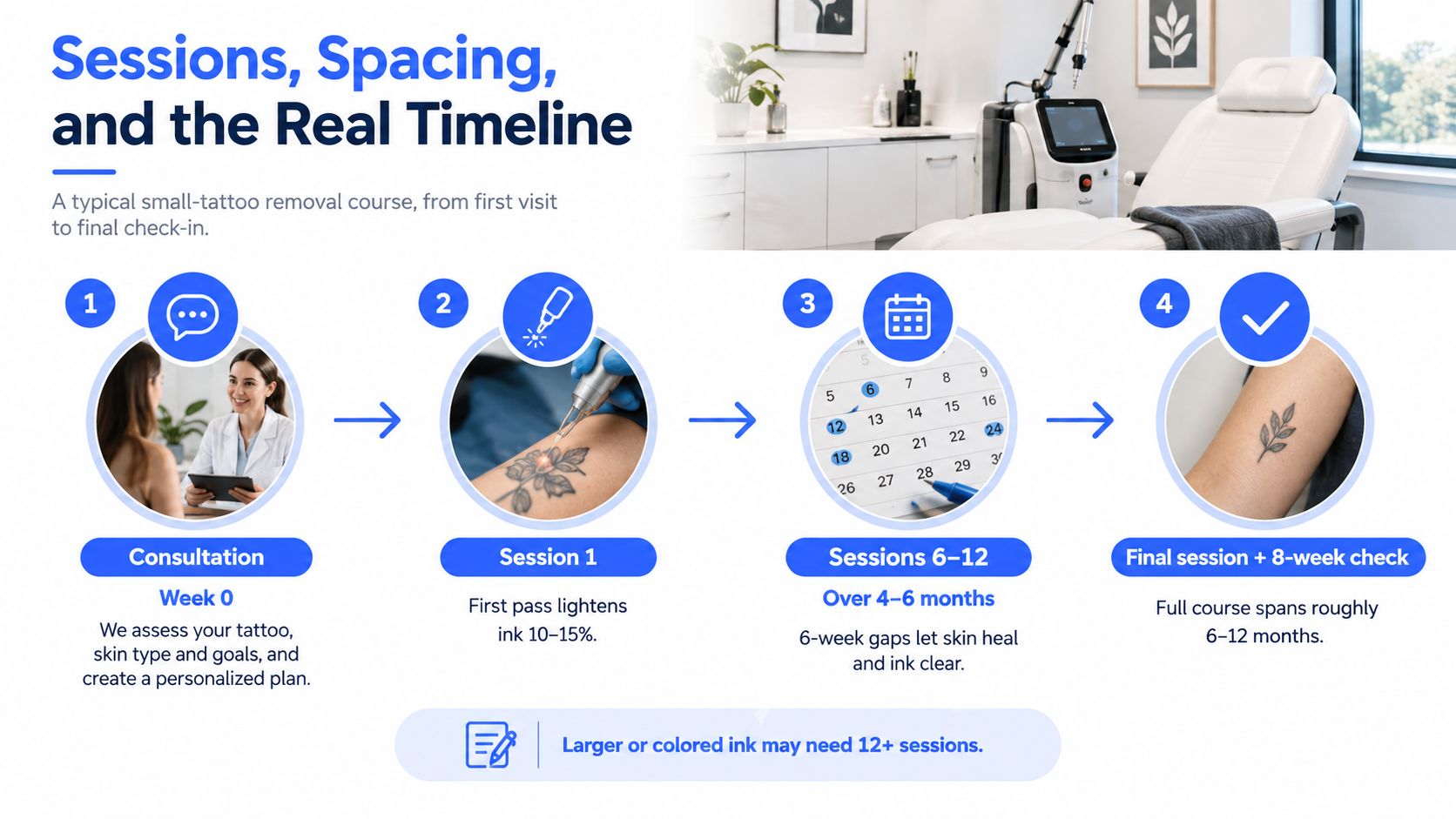 A four-step infographic illustrating the typical timeline for professional small-tattoo removal sessions and healing.