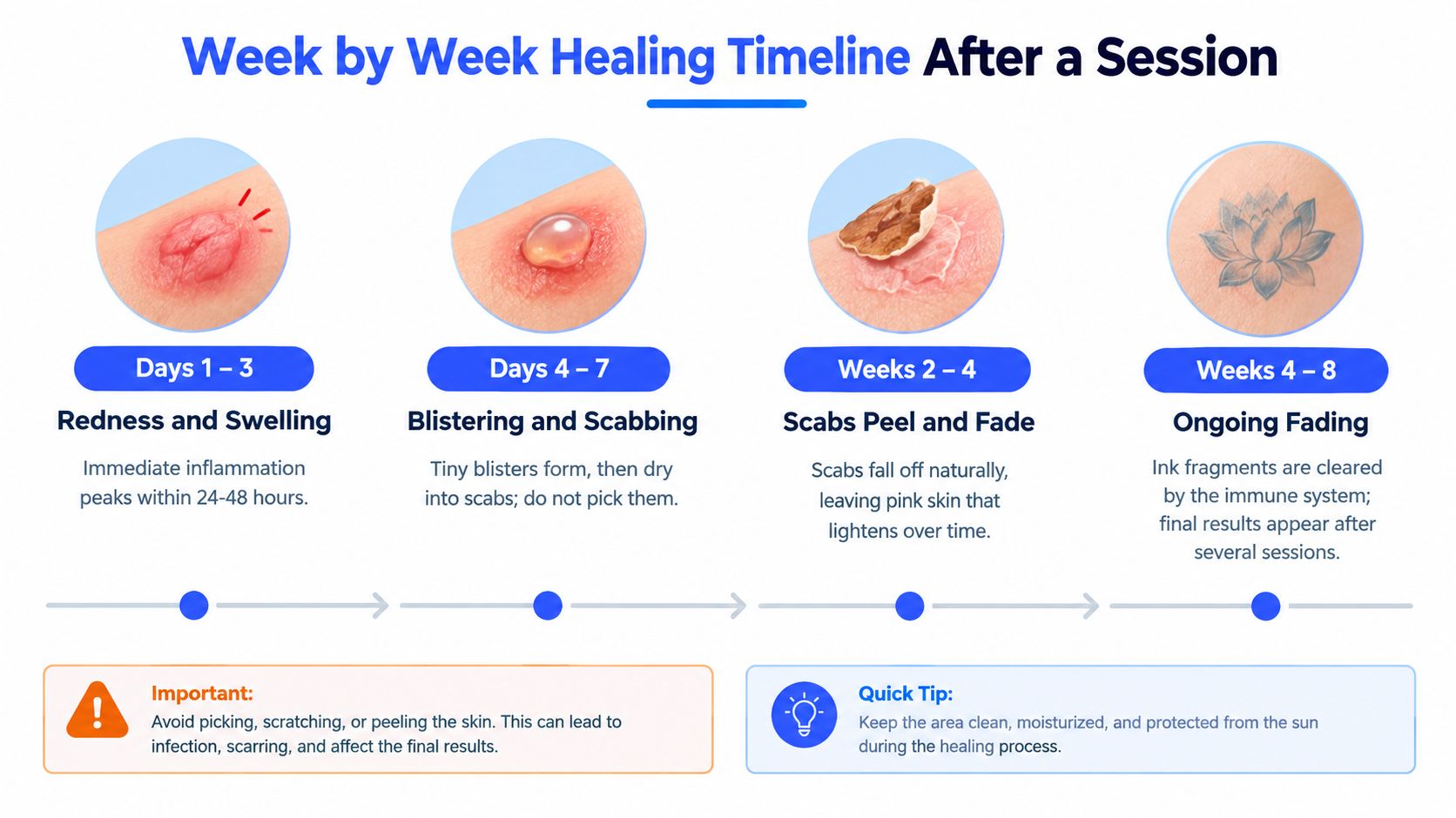 A visual guide illustrating the week-by-week healing process after a professional laser tattoo removal session.