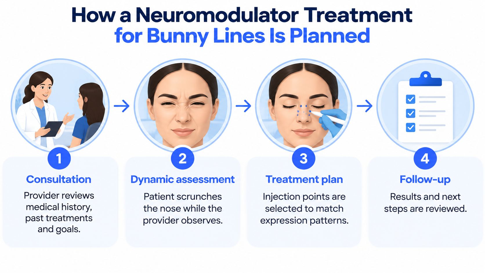 A four-step infographic illustrating the professional planning process for a neuromodulator treatment to correct bunny lines.