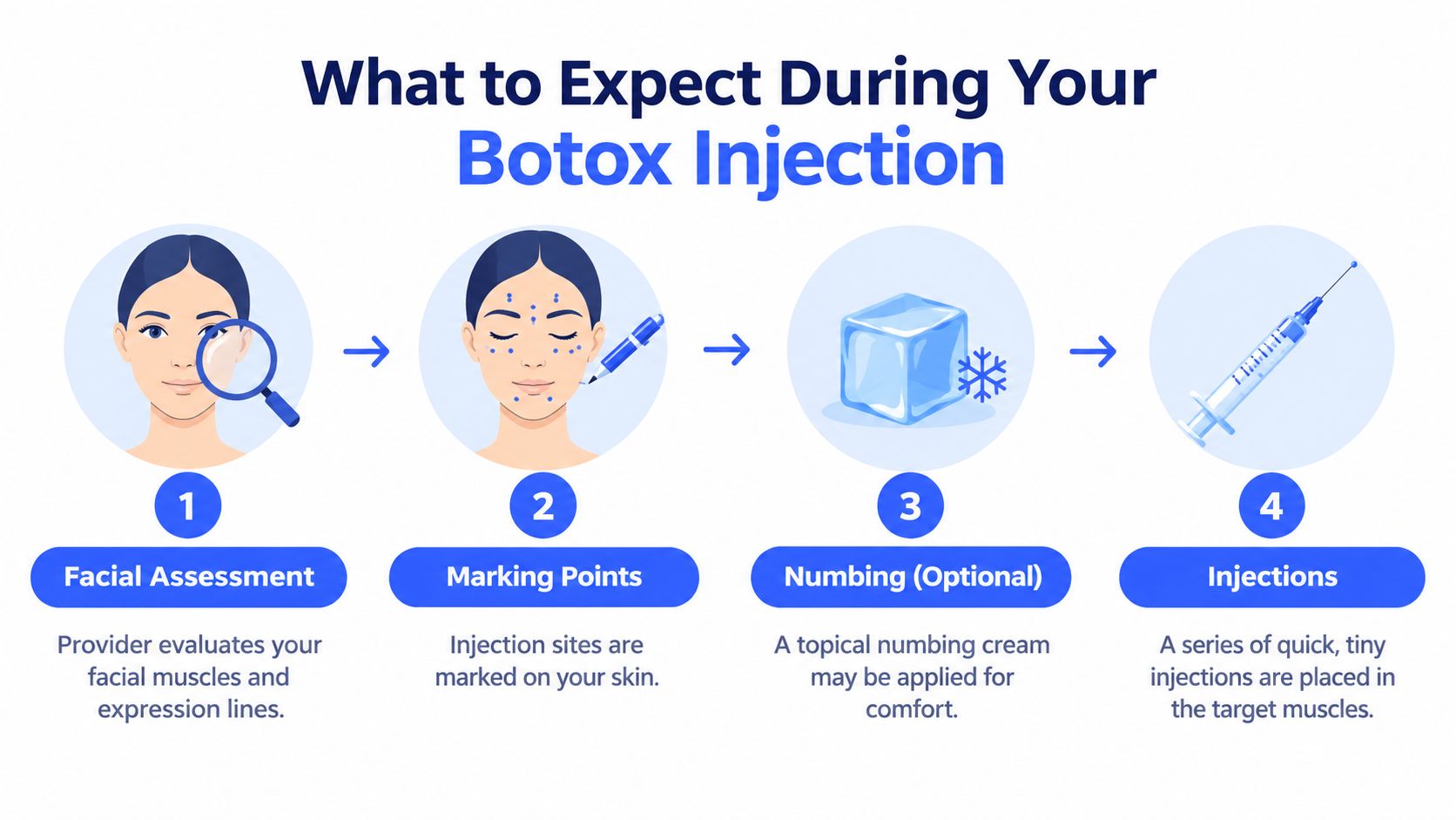 A four-step infographic illustrating the professional process of receiving a Botox injection, from facial assessment to final injections.