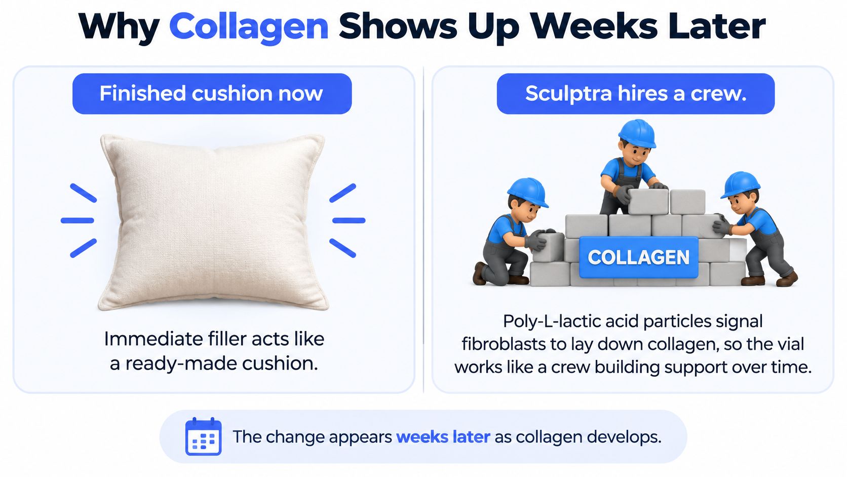 An infographic comparing immediate filler effects to the gradual collagen-building process of Sculptra injections over time.