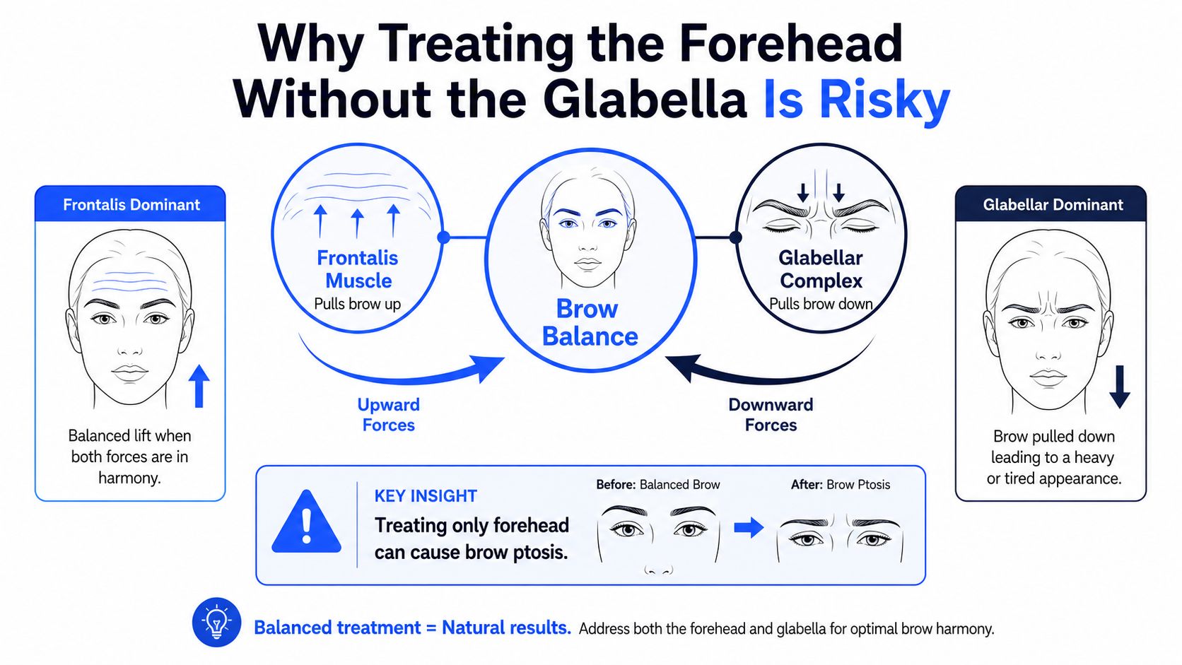 An infographic explaining the importance of balancing forehead and glabellar muscle treatments to prevent brow ptosis.