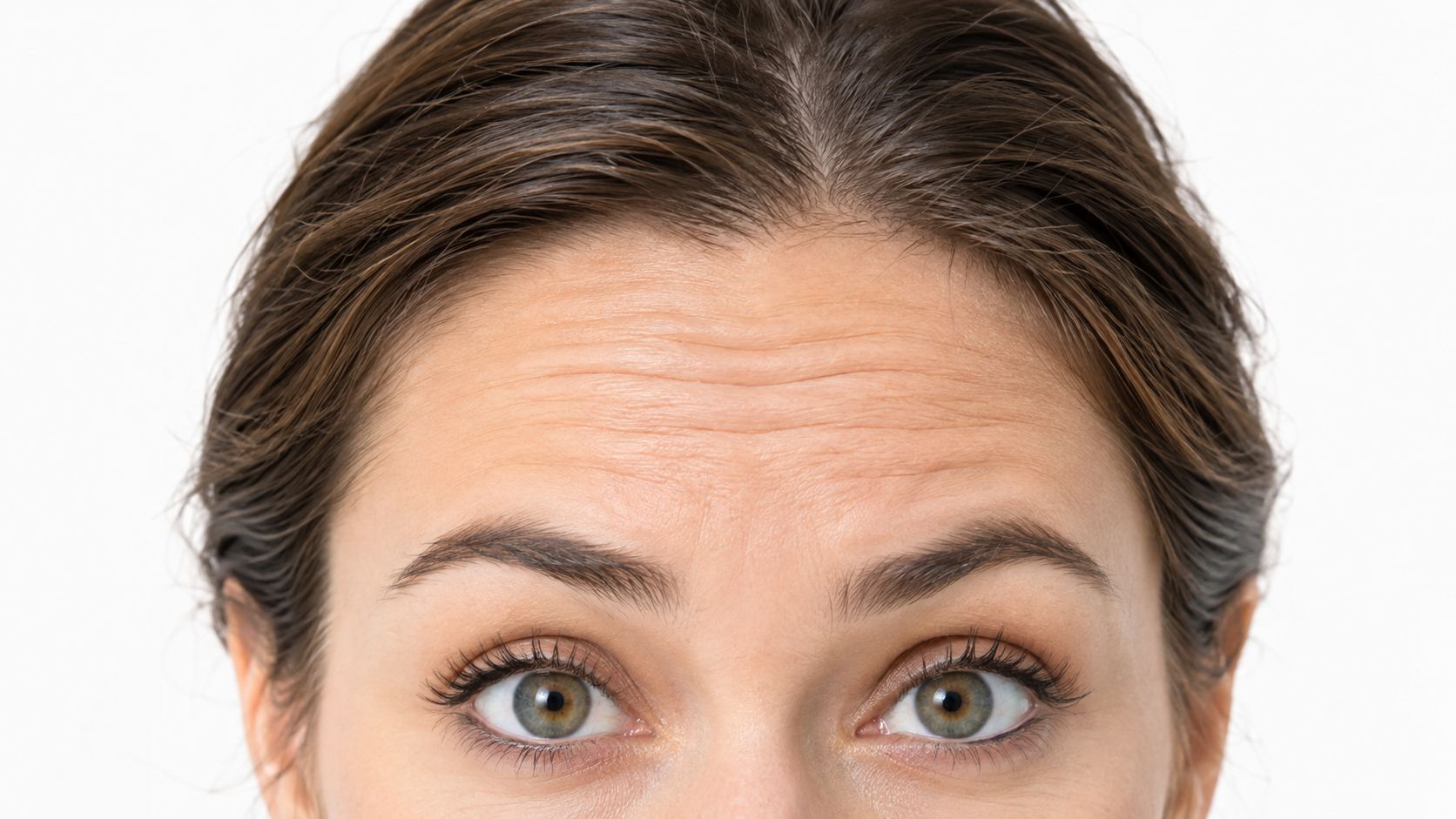 Close-up of a woman's forehead showing visible horizontal wrinkles and raised eyebrows on a white background.