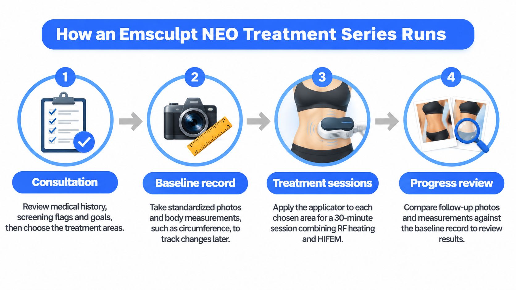 A four-step infographic illustrating the process of an Emsculpt NEO treatment series from consultation to progress review.